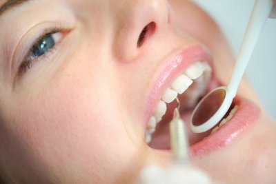 Àrea d'Odontologia i Cirurgia Oral i Maxil·lofacial - Odontologia preventiva i consevadora